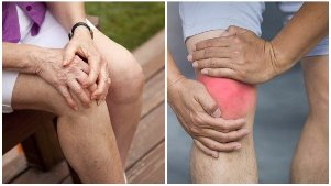 die Symptome der osteoarthritis